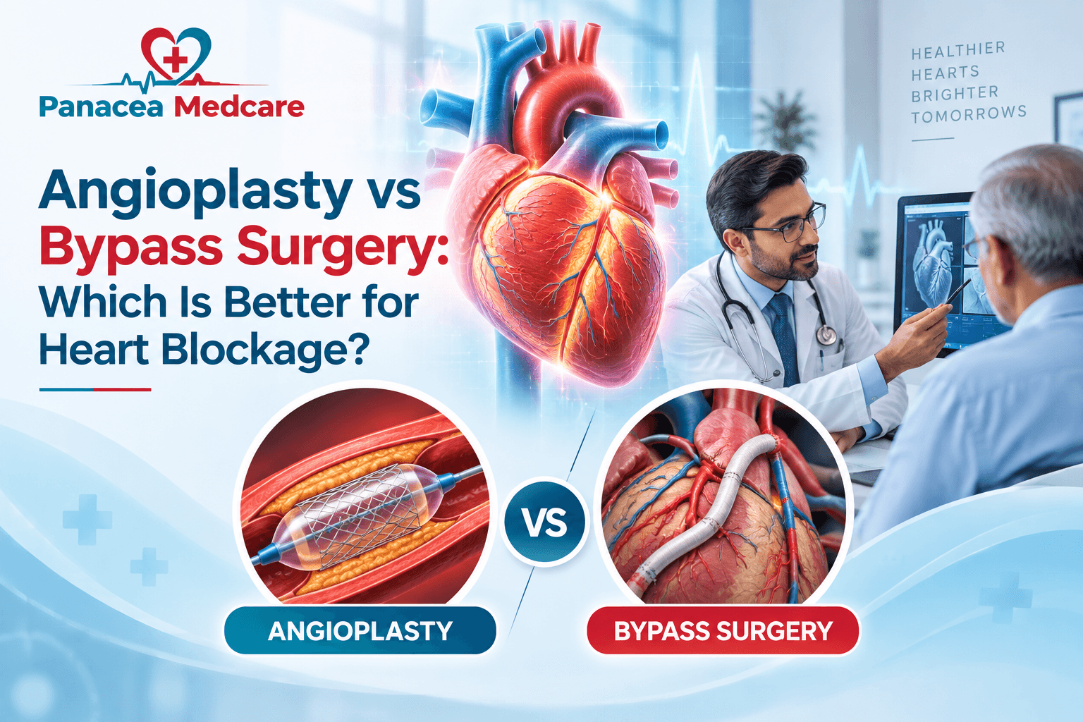 Angioplasty vs Bypass Surgery: Which Is Better for Heart Blockage