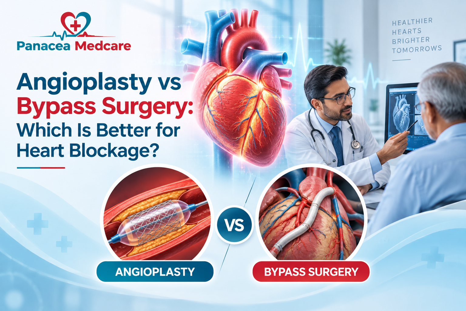 Angioplasty-vs-Bypass-Surgery-Infographic.png